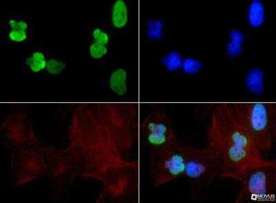 Immunocytochemistry/ Immunofluorescence: Histone H3 [ac Lys9, ac Lys14] Antibody - BSA Free [NB21-1081]